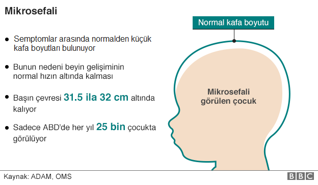 160127141134_microcephaly_624in_turkish.png